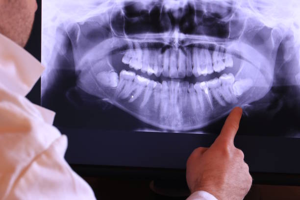 Best Urgent Tooth Repair  in Bokeelia, FL