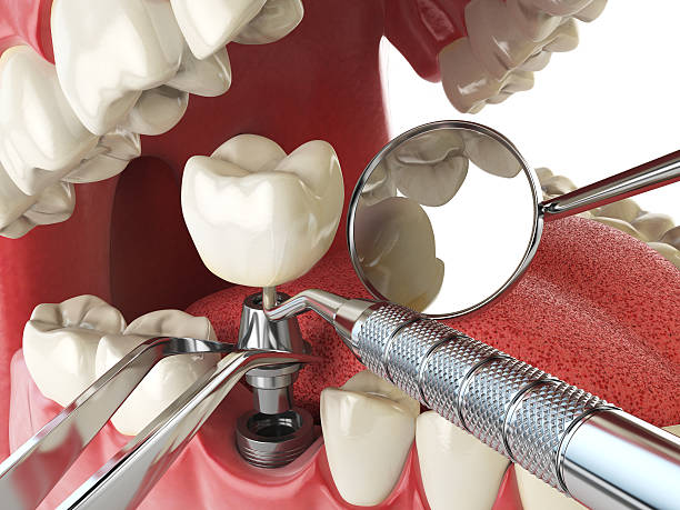 Best Tooth Infection Emergency Dentist  in Bokeelia, FL